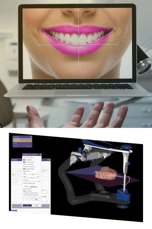 Planejamento virtual em implantodontia e reabilitação oral, com digitalização do paciente, encadeamento de imagens DICOM e STLs, e comunicação avançada entre planner e CD.