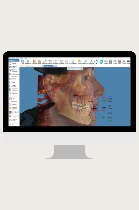 Planejamento digital 3D de deformidades dentofaciais com envio de arquivos DICOM, fotos e análise facial, utilizando Dolphin Imaging® e impressão de splints cirúrgicos e guias de mentoplastia.